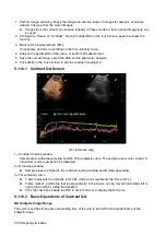 Предварительный просмотр 158 страницы Mindray DC-80A Operator'S Manual