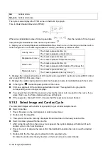 Предварительный просмотр 184 страницы Mindray DC-80A Operator'S Manual