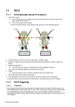 Предварительный просмотр 198 страницы Mindray DC-80A Operator'S Manual