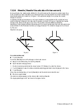 Предварительный просмотр 319 страницы Mindray DC-80A Operator'S Manual