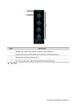 Предварительный просмотр 371 страницы Mindray DC-80A Operator'S Manual