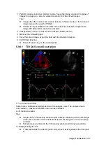 Preview for 115 page of Mindray DC-T6 Operator'S Manual