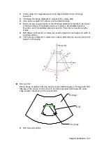 Preview for 121 page of Mindray DC-T6 Operator'S Manual