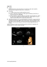 Preview for 134 page of Mindray DC-T6 Operator'S Manual