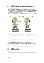 Preview for 180 page of Mindray DC-T6 Operator'S Manual