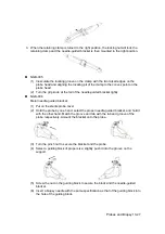 Preview for 263 page of Mindray DC-T6 Operator'S Manual