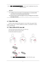 Предварительный просмотр 18 страницы Mindray EPA001 Operator'S Manual