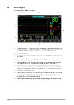 Preview for 40 page of Mindray ePM 10M Operator'S Manual