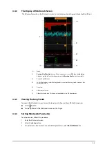 Preview for 53 page of Mindray ePM 10M Operator'S Manual