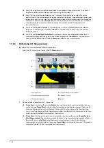 Preview for 160 page of Mindray ePM 10M Operator'S Manual