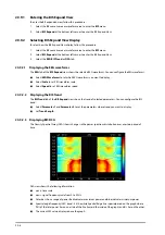 Preview for 190 page of Mindray ePM 10M Operator'S Manual