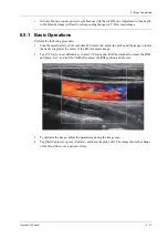 Preview for 139 page of Mindray Imagyn 7 Operator'S Manual