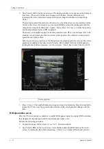 Preview for 142 page of Mindray Imagyn 7 Operator'S Manual