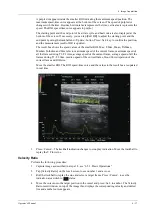 Preview for 143 page of Mindray Imagyn 7 Operator'S Manual