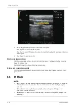 Preview for 146 page of Mindray Imagyn 7 Operator'S Manual