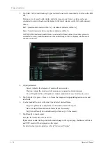 Preview for 162 page of Mindray Imagyn 7 Operator'S Manual