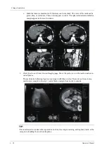 Preview for 184 page of Mindray Imagyn 7 Operator'S Manual