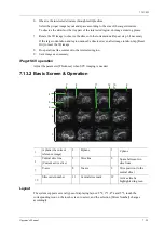 Preview for 225 page of Mindray Imagyn 7 Operator'S Manual