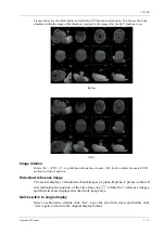 Preview for 227 page of Mindray Imagyn 7 Operator'S Manual