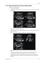 Preview for 231 page of Mindray Imagyn 7 Operator'S Manual