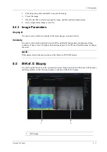 Preview for 253 page of Mindray Imagyn 7 Operator'S Manual