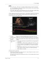 Preview for 259 page of Mindray Imagyn 7 Operator'S Manual