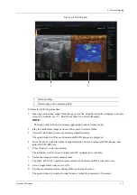 Preview for 263 page of Mindray Imagyn 7 Operator'S Manual