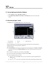 Preview for 121 page of Mindray iMEC8 Vet Operator'S Manual