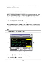 Preview for 123 page of Mindray iMEC8 Vet Operator'S Manual