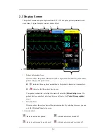 Preview for 28 page of Mindray iPM-9800 Operator'S Manual