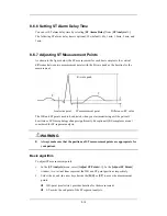 Preview for 92 page of Mindray iPM-9800 Operator'S Manual