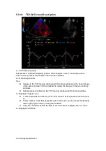 Preview for 116 page of Mindray M5 Exp Operator'S Manual