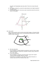 Preview for 123 page of Mindray M5 Exp Operator'S Manual