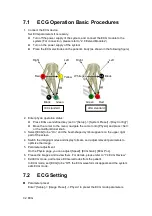 Preview for 184 page of Mindray M5 Exp Operator'S Manual