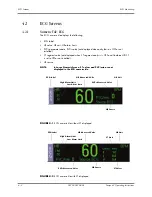 Предварительный просмотр 63 страницы Mindray Passport V Operating Instructions Manual