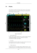 Preview for 36 page of Mindray PM-9000 Operation Manual