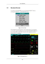 Preview for 88 page of Mindray PM-9000 Operation Manual