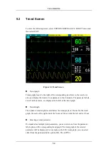 Preview for 89 page of Mindray PM-9000 Operation Manual