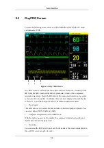 Preview for 90 page of Mindray PM-9000 Operation Manual