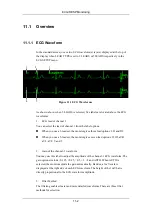 Preview for 138 page of Mindray PM-9000 Operation Manual