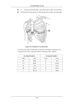 Preview for 144 page of Mindray PM-9000 Operation Manual