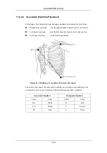 Preview for 145 page of Mindray PM-9000 Operation Manual