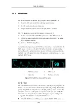 Preview for 186 page of Mindray PM-9000 Operation Manual