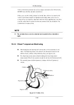 Preview for 270 page of Mindray PM-9000 Operation Manual