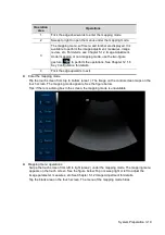 Preview for 61 page of Mindray Resona 7 Operator'S Manual