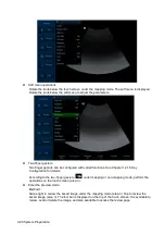 Preview for 62 page of Mindray Resona 7 Operator'S Manual