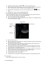 Preview for 78 page of Mindray Resona 7 Operator'S Manual