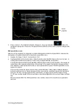 Preview for 100 page of Mindray Resona 7 Operator'S Manual