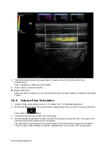 Preview for 102 page of Mindray Resona 7 Operator'S Manual