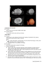 Preview for 131 page of Mindray Resona 7 Operator'S Manual